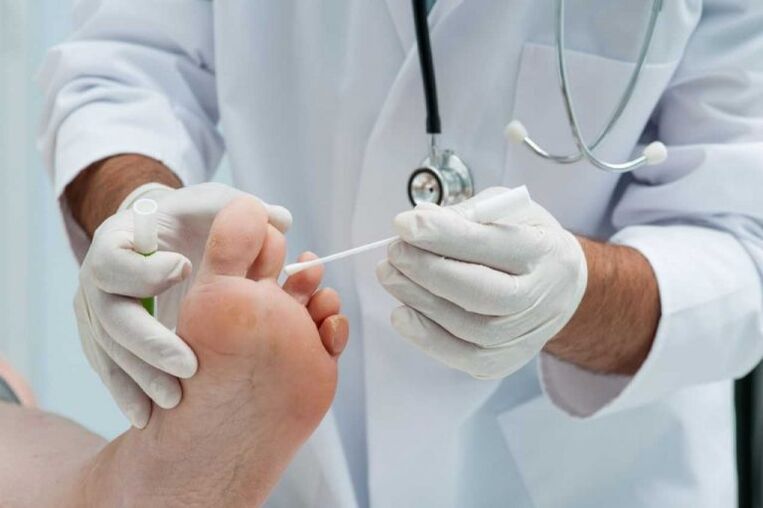 Wer behandelt den Nagelpilz